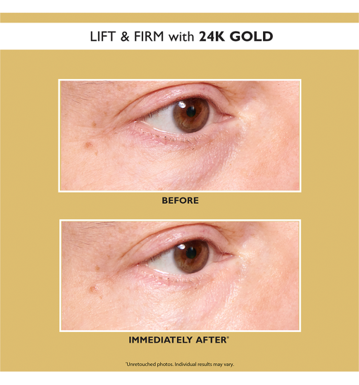 Peter Thomas Roth Hydra-Gel Travel Pack 4-Pairs