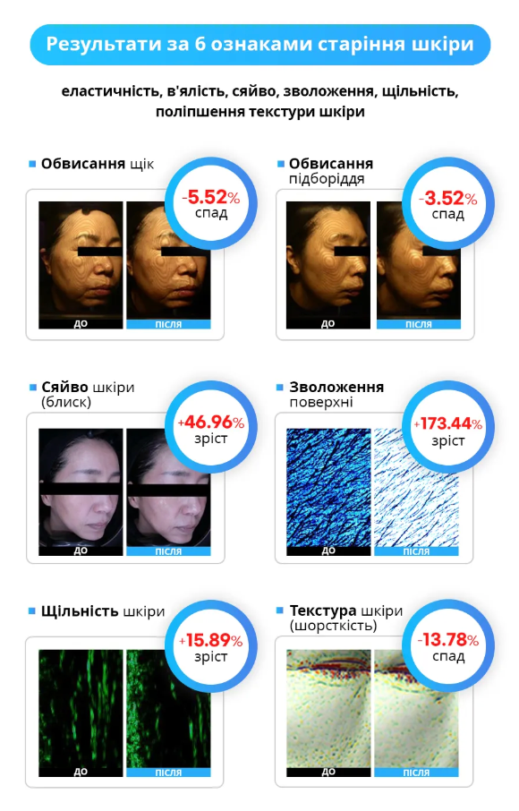 HISONIC.M Ultrasound + HIFU Multi-Device