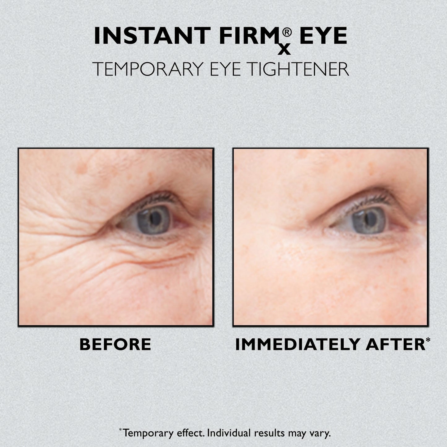 PETER THOMAS ROTH INSTANT FIRMX EYE TEMPORARY EYE TIGHTENER