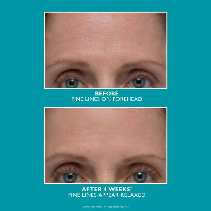 PETER THOMAS ROTH PEPTIDE SKINJECTION AMPLIFIED WRINKLE-FIX SERUM