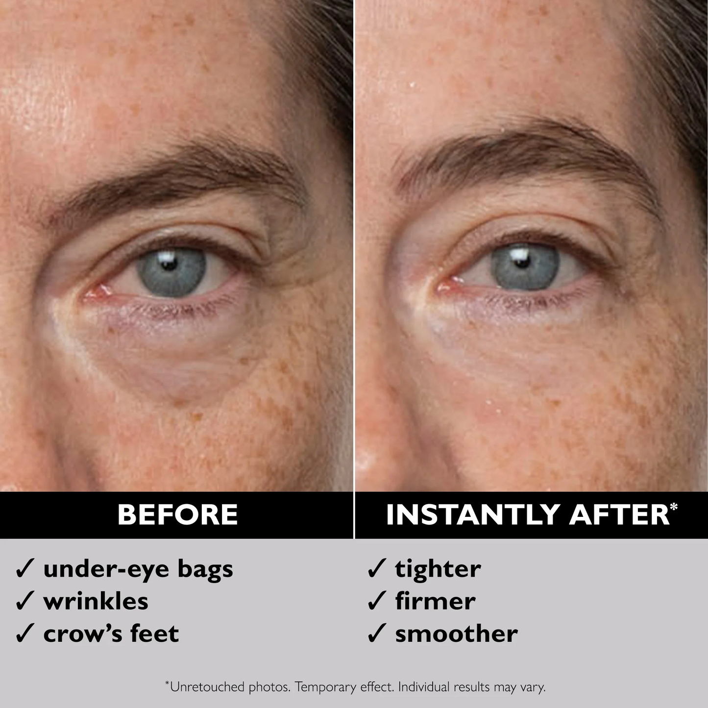 PETER THOMAS ROTH INSTANT FIRMX EYE TEMPORARY EYE TIGHTENER