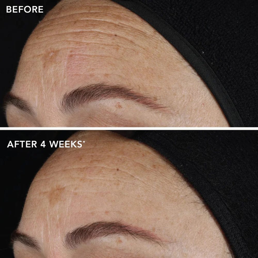 IMAGE Skincare Ageless+ Retinol Pure Liquid Retinol 0.1%