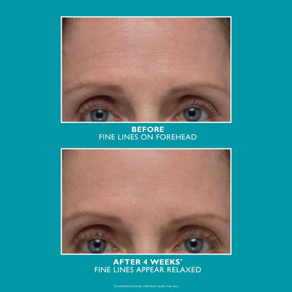 PETER THOMAS ROTH PEPTIDE SKINJECTION AMPLIFIED WRINKLE-FIX SERUM