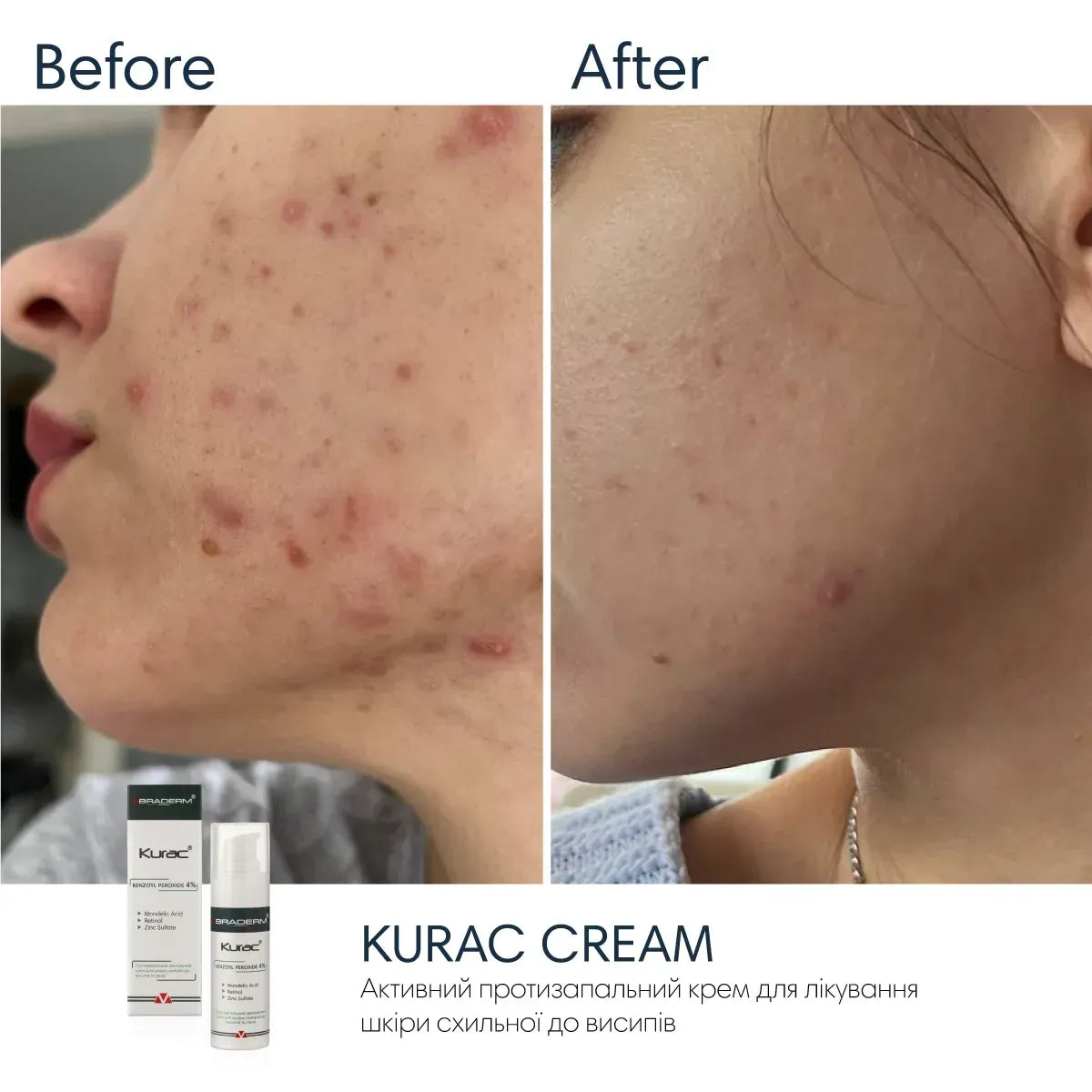 Braderm Kurac Set