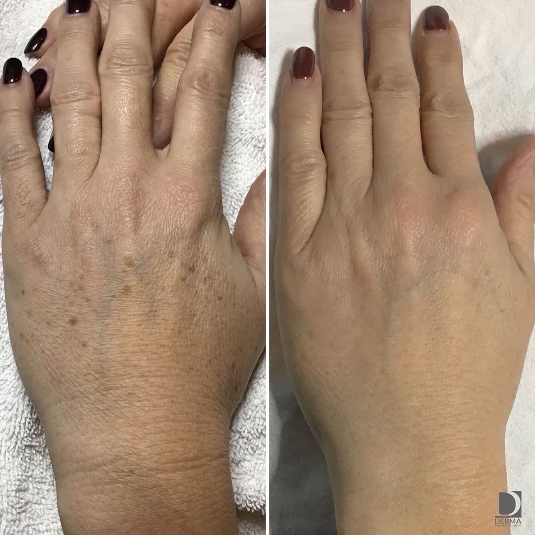 Intime Organique Whitening Cream